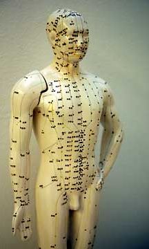 Akupunktio sopii periaatteessa kaikille.