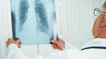keuhkot, röntgenkuva, lääkäri