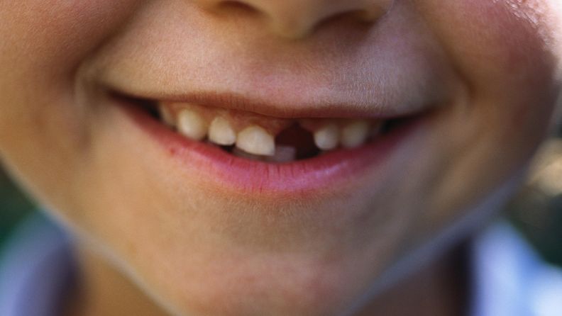 lapsi hammas hymy hampaat