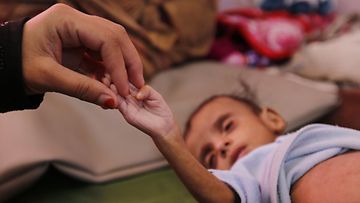 EPA Jemen nälänhätä  h_54780331